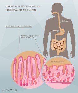 blog-anaflavia-oliveira-intolerancia-ao-gluten-e-queda-capilar-imagem
