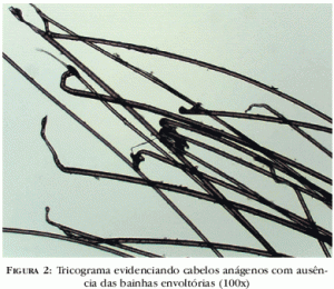 a012fig2